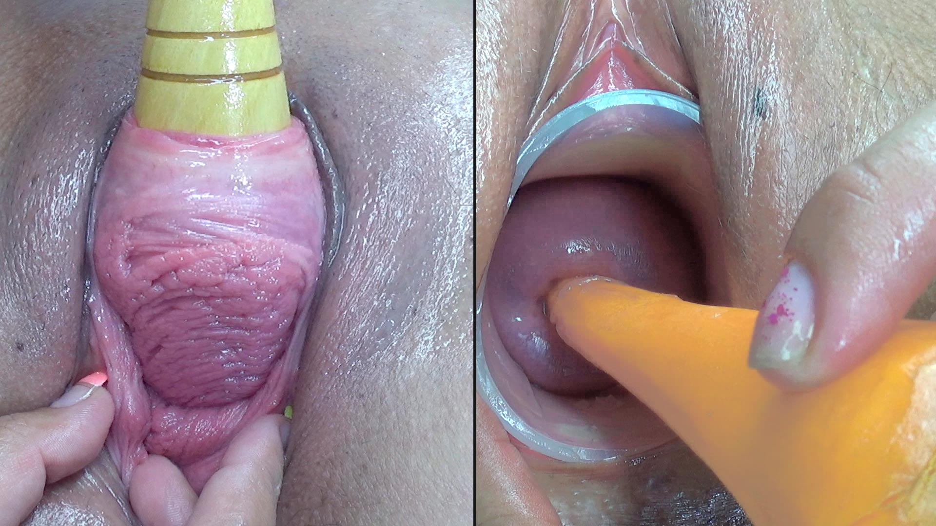 cervix fucking 
